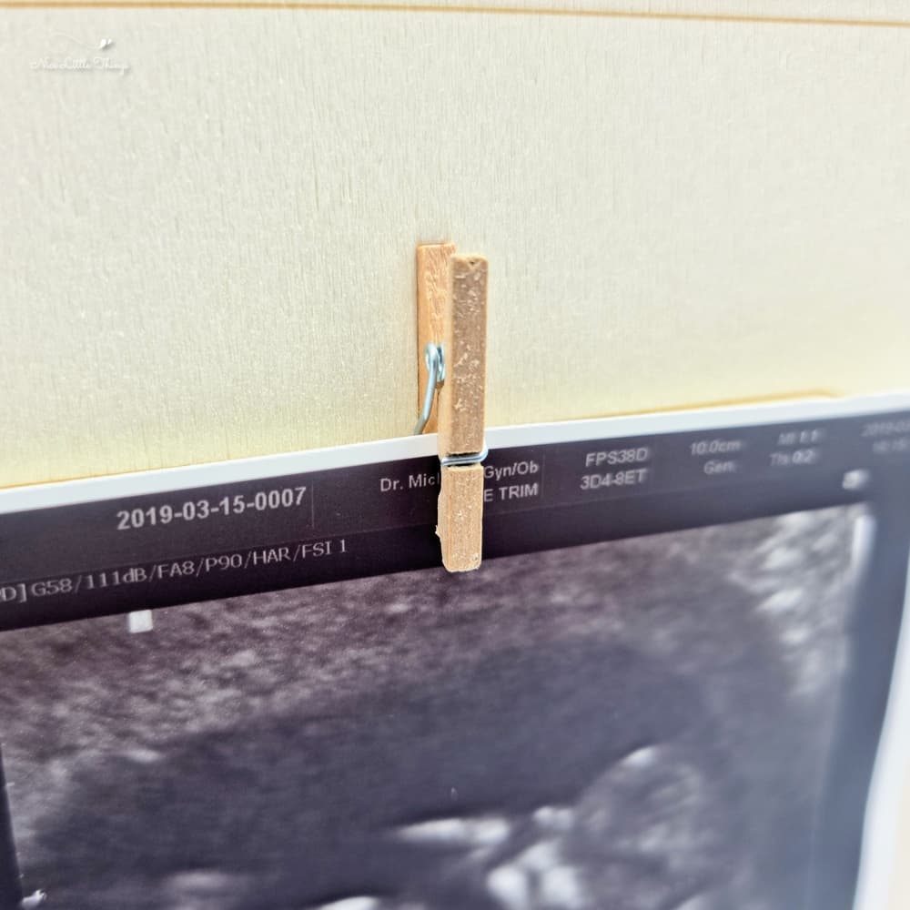 Zwangerschapsaankondiging Echo